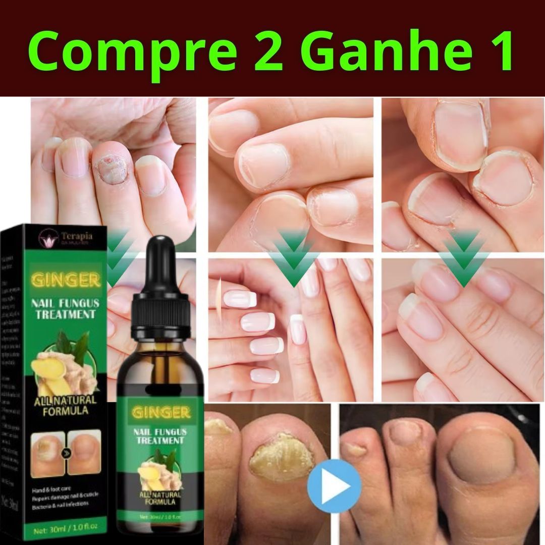 100 Onicomicose Green Life™ - Terapia da Mulher