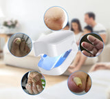 Laserterapia Contra Fungo nas Unhas