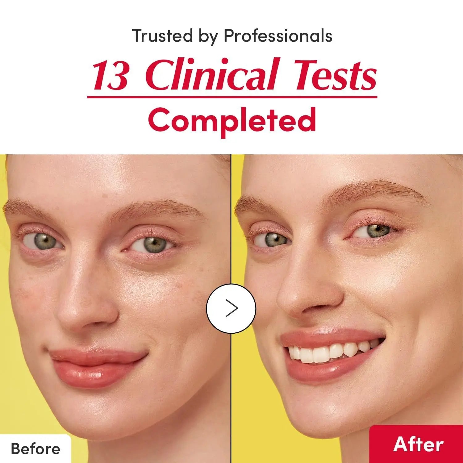 Sérum Anti-Idade 3 em 1 | Bakuchiol + Niacinamida + Vitamina C - VitaGlow Pro™