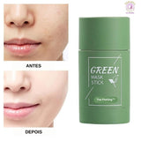 Eliminates Blackheads and Pimples - Tea Peeling™ Natural Mask - *Pay R$ 68.32 un 